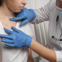 A nurse checking an adolescent's rash on their body