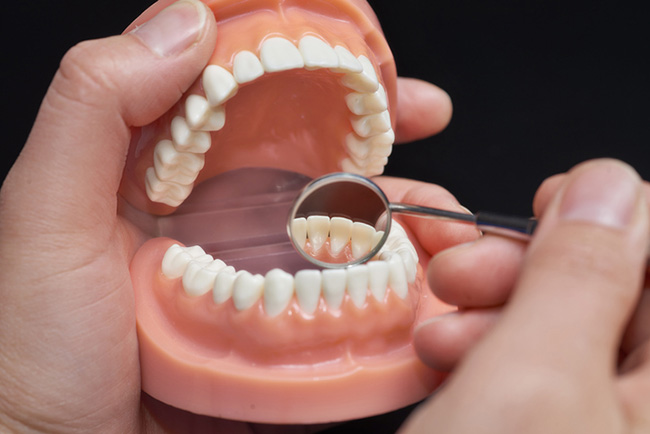 Dental check