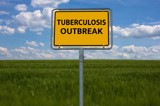 TB Outbreak sign