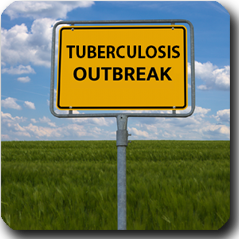 TB Outbreak