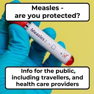 A measles test vial