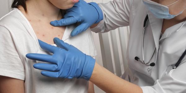 A nurse checking an adolescent's rash on their body